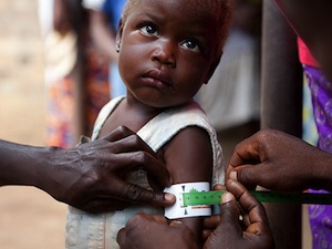 Sous-alimentation en Afrique