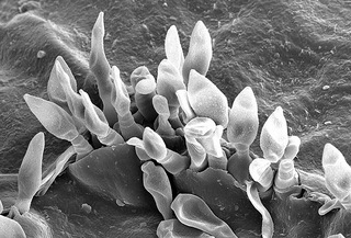 Spores de champignon (Venturia inaequalis - tavelure)