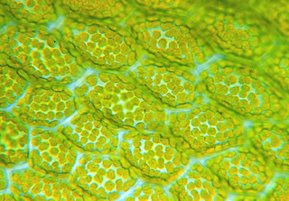 Cellules végétales contenant des chloroplastes