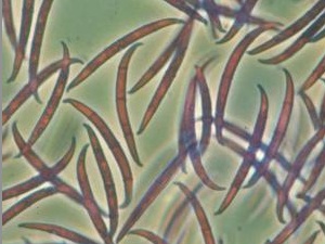 Spores de fusarium
