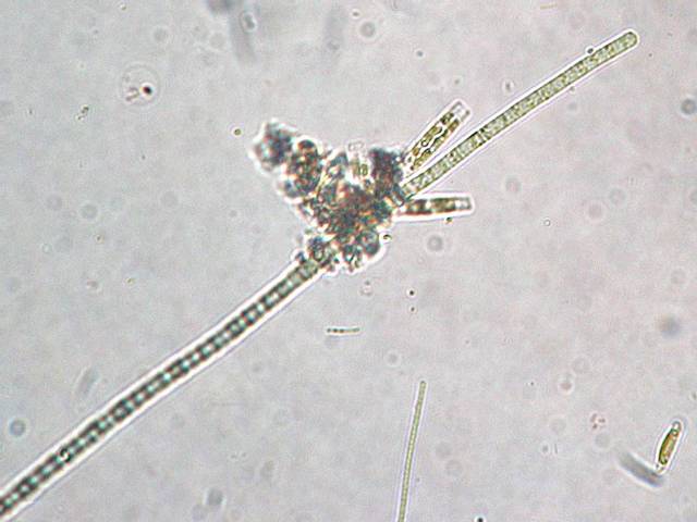 Cellules réunies en filament de Aphanizomenon flos-aquae vue au microscope